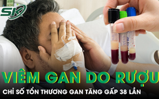 Nguy Cơ Sức Khỏe Khi Ăn Uống: Câu Chuyện Đáng Lo Ngại Về Sán Dây