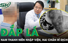 Khám Phá 3 Loại Cá Rẻ Tiềm Năng Dinh Dưỡng Tại Chợ Việt