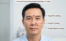 Khám Phá 5 Món Canh Củ Sen Bổ Dưỡng Cho Sức Khỏe