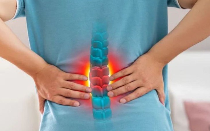 Đau lưng dưới có thể là dấu hiệu của những bệnh gì?- Ảnh 1.