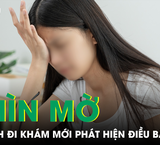 Que cấy tránh thai: Đối tượng nào phù hợp và không phù hợp?