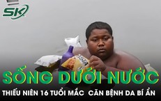 Cảnh Báo Sức Khỏe: Nguyên Nhân Chết Người Từ Thói Quen Ăn Uống Sai Lầm