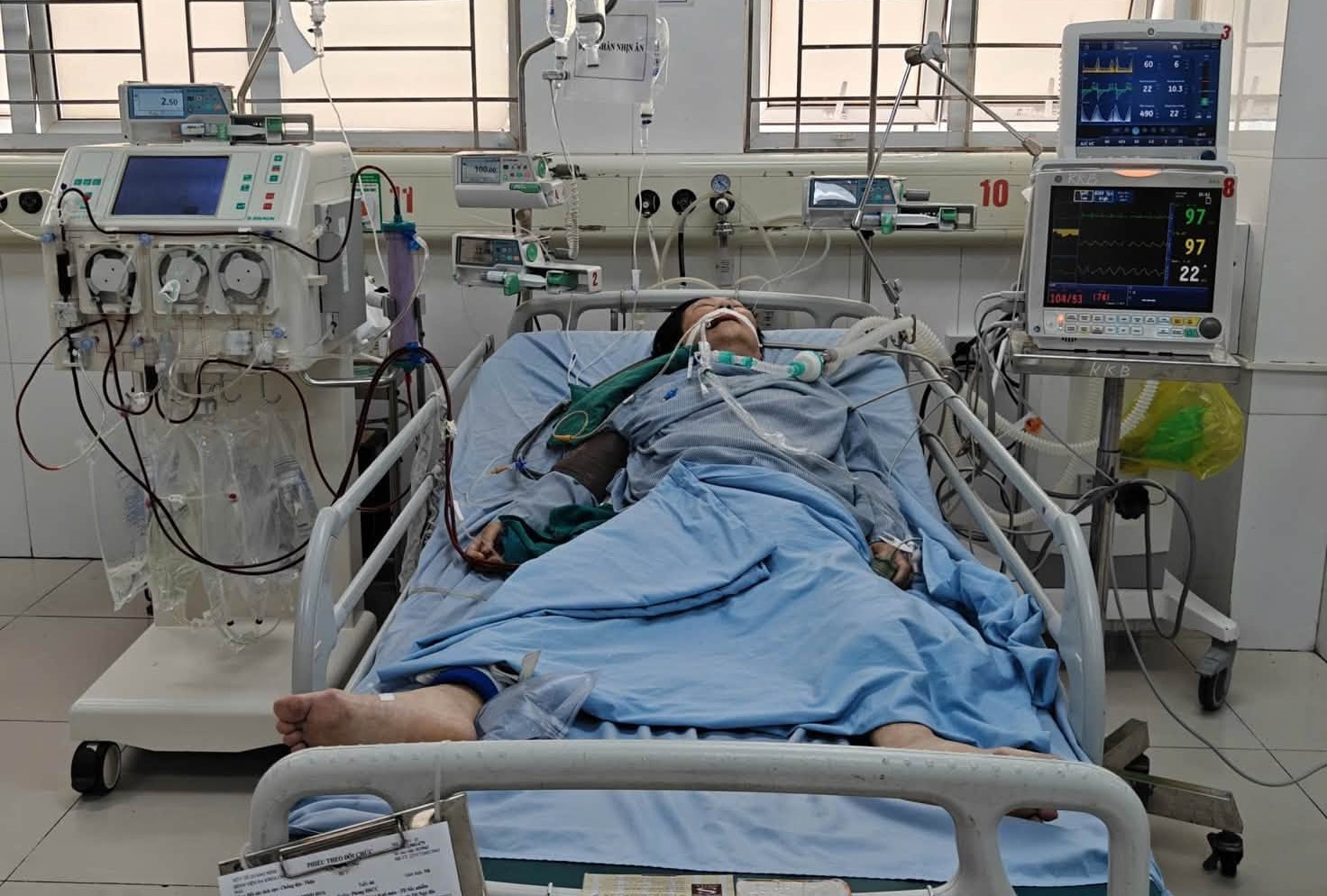 5-178653296503596505048 23 ngày giành sự sống cho bệnh nhân sốc nhiễm khuẩn, suy đa tạng nguy kịch- Ảnh 1.