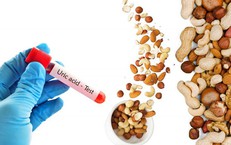 Tìm Hiểu Mối Quan Hệ Giữa Kỳ Kinh và Cơn Đau Nửa Đầu