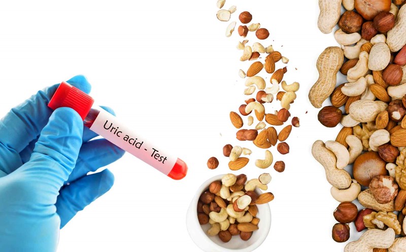 Khám Phá Nguyên Nhân Tăng Acid Uric: Không Chỉ Là Hải Sản