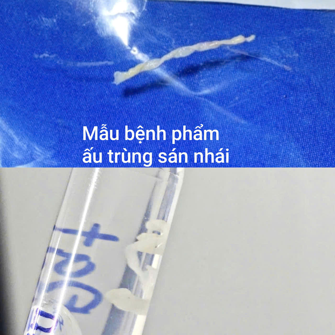 Nguy hiểm sức khỏe khi vô tình tiếp xúc với nước suối không an toàn - Ảnh 2.