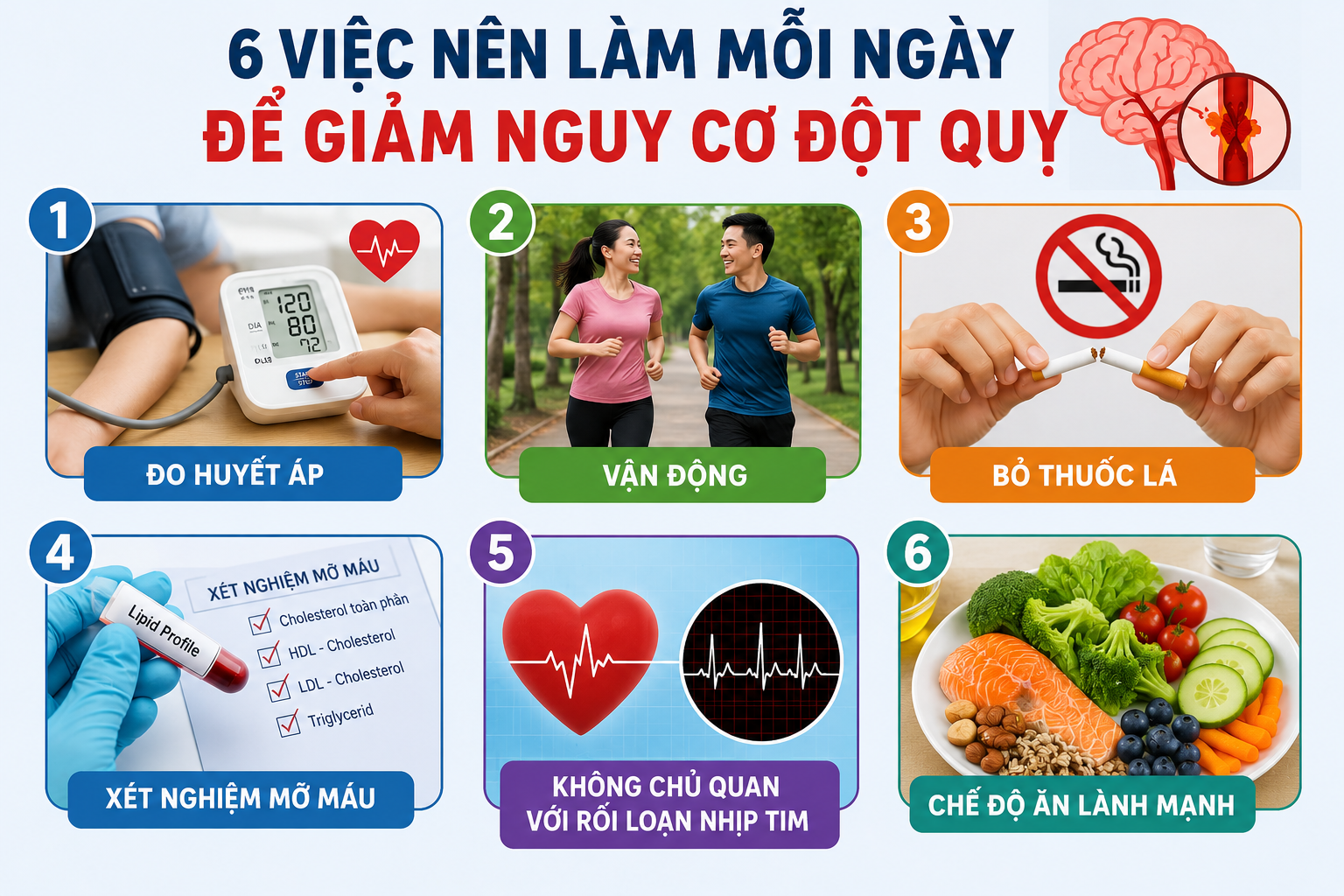 Biện Pháp Ngăn Ngừa Đột Quỵ Ở Người Có HIV Mắc Tăng Huyết Áp