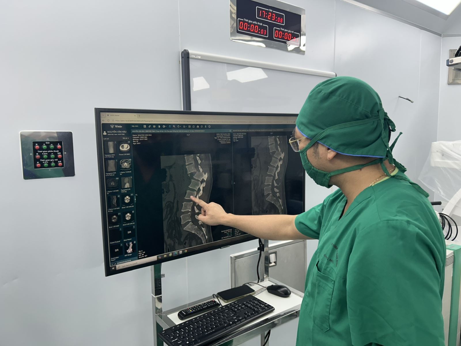 Bác sĩ đánh giá tình trạng trượt hoàn toàn đốt sống của bệnh nhân H. qua phim chụp cắt lớp