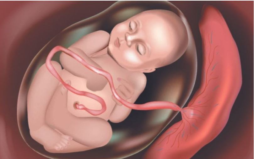 Khám Phá Biến Chứng Hiếm Gặp: Nhau Cài Răng Lược Ở Sản Phụ Đầu Tiên