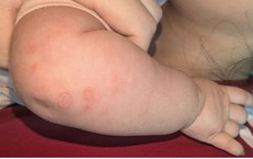 Giải Pháp Lưu Giữ Tế Bào Gốc Từ Dây Rốn Tại PhenikaaMec