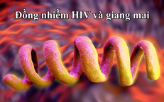 Giải Pháp Tăng Cường Sinh Lý Nam: Chọn Lựa Thông Minh Để Bảo Vệ Sức Khỏe