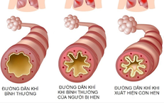 Cách Nhận Biết Khi Nào Cần Đưa Trẻ Đi Cấp Cứu Sau Khi Bị Sặc Nước
