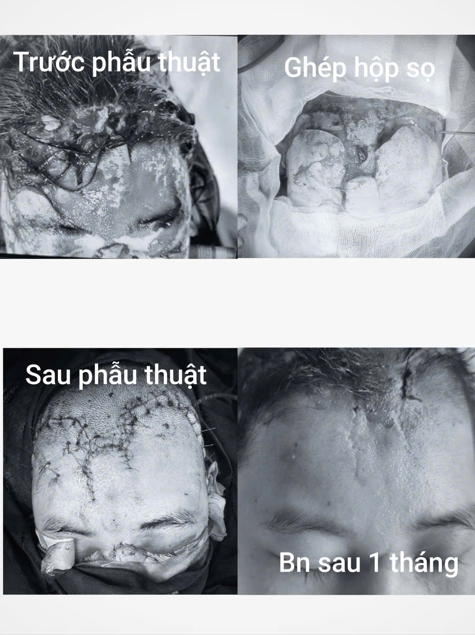 hinh-anh-chan-thuong-truoc-va-sau-phau-thuat-17878170788631154750978 Hình ảnh chấn thương ở bệnh nhân trước và sau phẫu thuật. Ảnh: BVCC