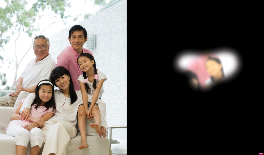 Những Nguy Cơ Mất Thị Lực Từ Glaucoma: Các Dấu Hiệu và Phương Pháp Điều Trị