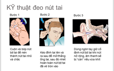 Những Nguy Cơ Giang Mai Bẩm Sinh: Cảnh Báo và Biện Pháp Phòng Ngừa