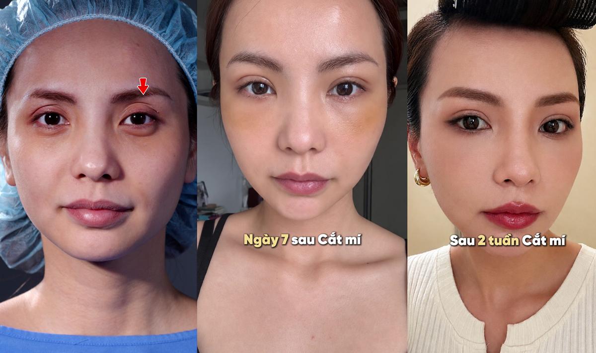 photo-1786519033302-17865190337491388697847 Diễn viên, MC Bùi Linh Chi trẻ hơn sau khi thay đổi một chi tiết trên gương mặt- Ảnh 3.