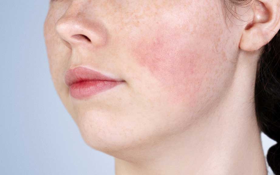 Khám Phá Tác Dụng Của Retinol Trong Chăm Sóc Da Vùng Mắt