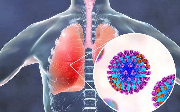 Dấu Hiệu Nguy Hiểm Của Viêm Phổi Do Adenovirus Ở Trẻ Em