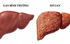 Tìm Hiểu Nguyên Nhân Gây Ngứa Vùng Kín Sau Khi Uống Kháng Sinh