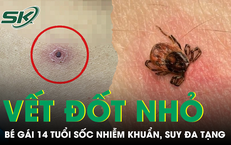 Hậu Quả Nghiêm Trọng Từ Việc Tiêu Thụ Thực Phẩm Để Lạnh: Câu Chuyện Của Người Phụ Nữ Gặp Bi Kịch Sức Khỏe