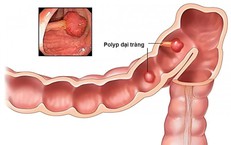 Dấu hiệu báo động: khi nào cần đưa trẻ sốt đến cơ sở y tế?