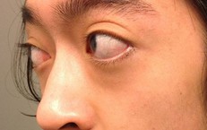 Lời Khuyên Dành Cho Nam Giới Có Bệnh Tim Khi Sử Dụng Thuốc Cường Dương