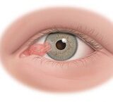 Ngủ ngon hơn: Chiến lược thói quen để cải thiện giấc ngủ