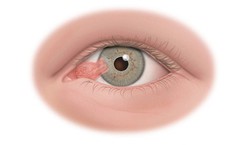 Ngủ ngon hơn: Chiến lược thói quen để cải thiện giấc ngủ